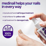 Jaysuin Nail Fungus Spray 100ml – Nail & Foot Care Spray